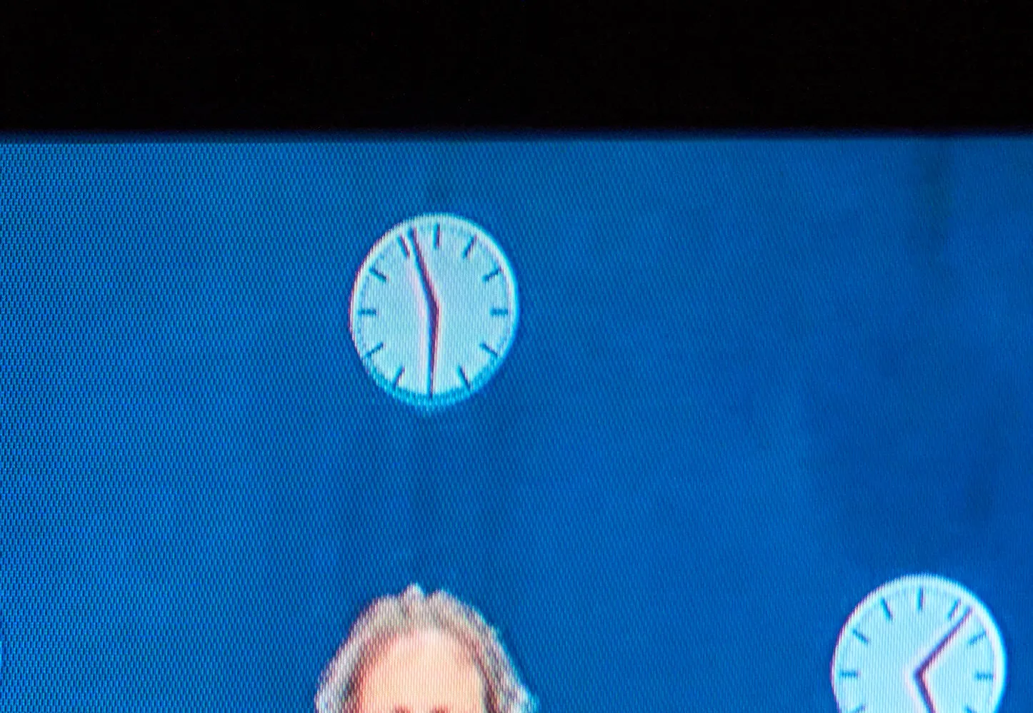 Someone’s forehead is visible and two clocks. On of them points at 7 past five, the other at four minutes to six. One of these clocks points at the right time.